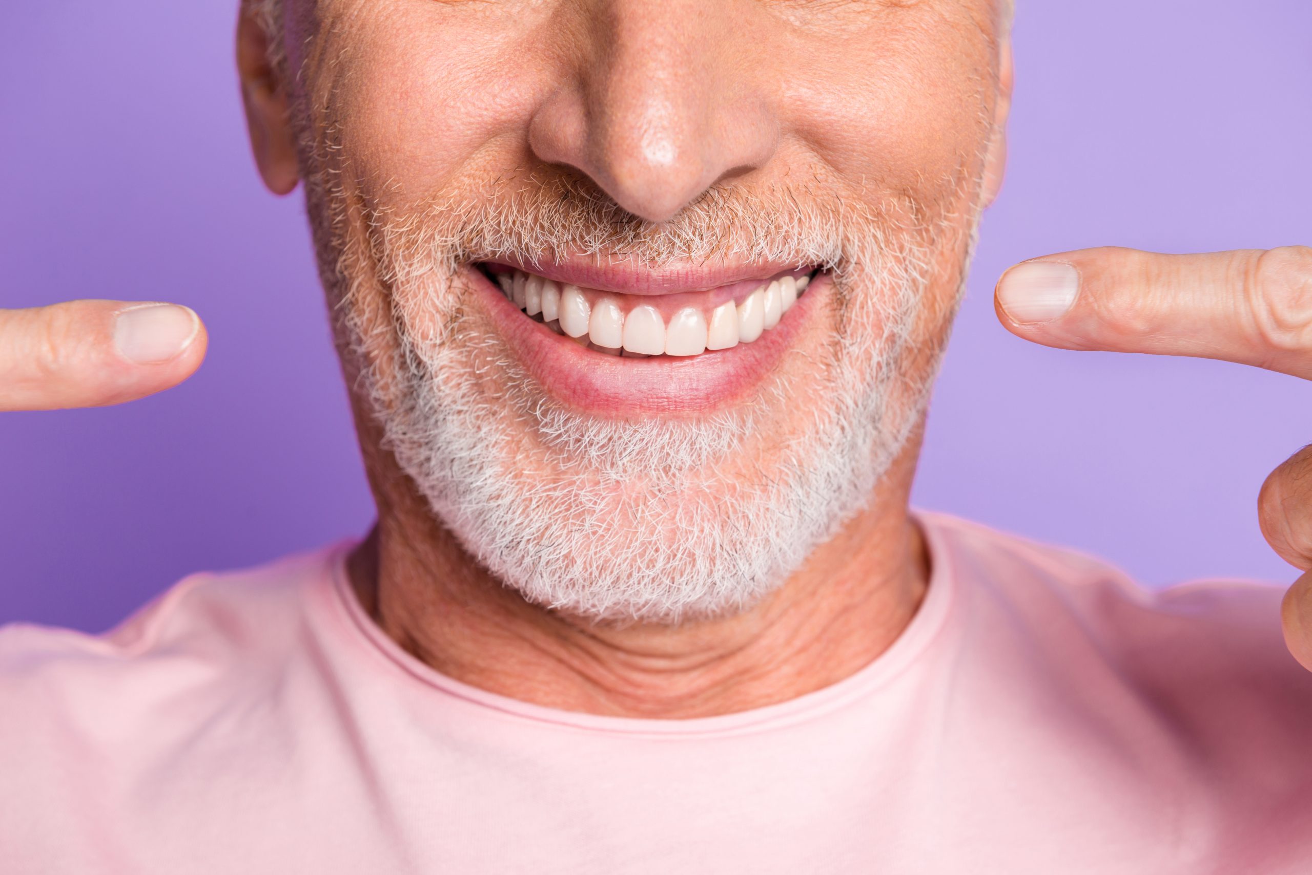 Implant-Supported Dentures